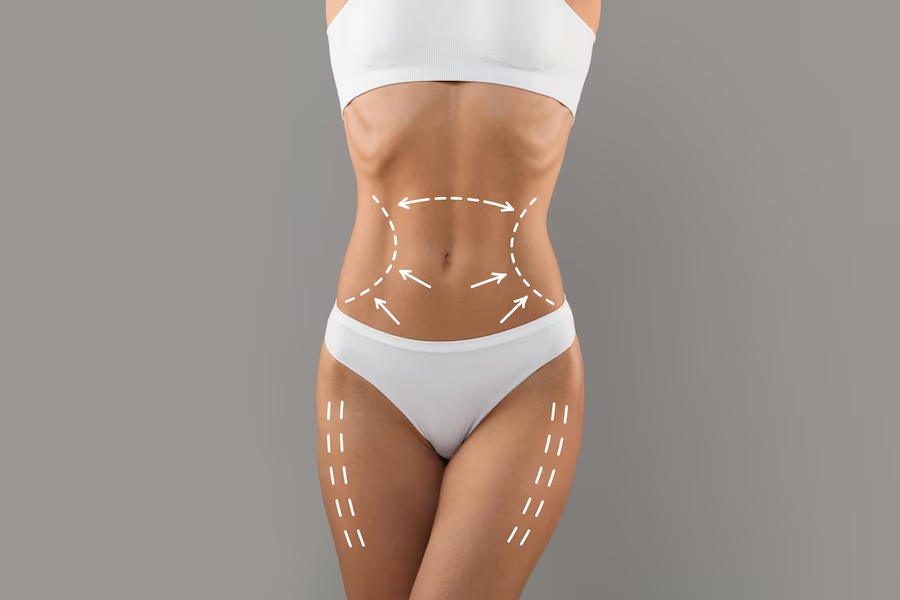 Body Contouring Near Me