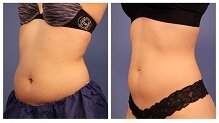 LowerAbdomen jpg